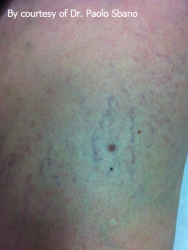Vascular_B&A_0001 Vascular_B&A_0001